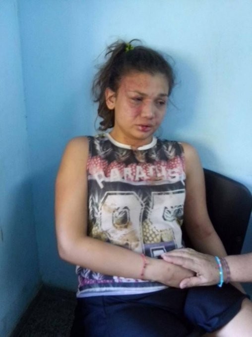 Asisten a joven clorindense agredida por su novio