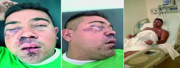 Pedirán a la Justicia Federal investigue presunta golpiza y torturas en el Rimte 29