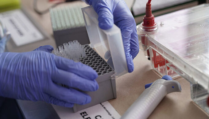 Estudio de PCR: Desde este lunes podrán realizarse hisopados en el laboratorio del Centro de Salud en La Nueva Formosa