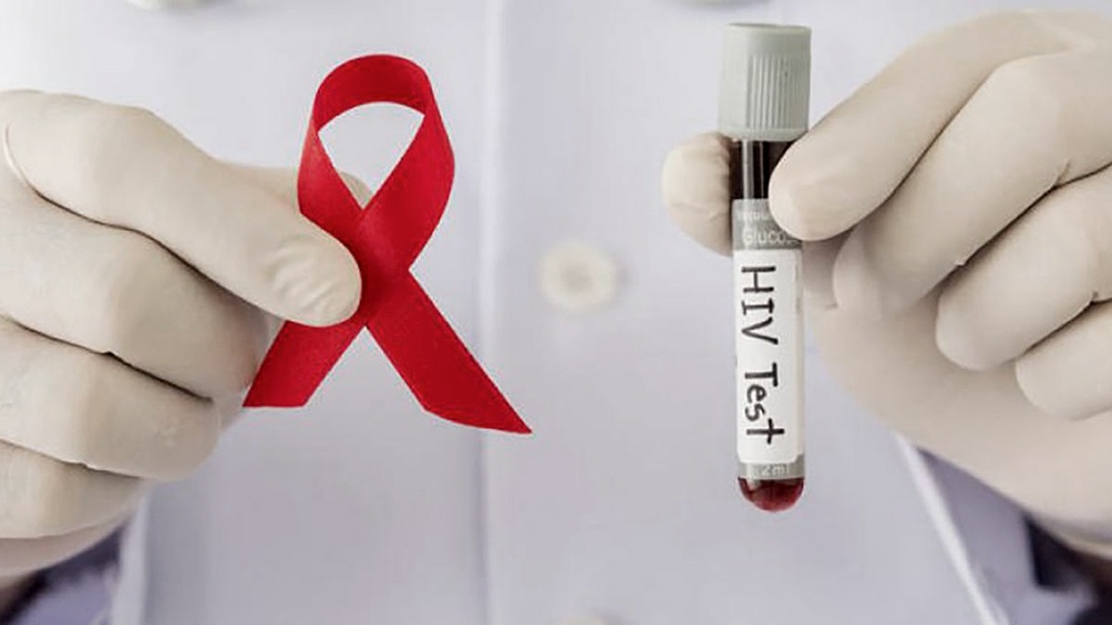 Remarcan importancia de hacerse el test o prueba del VIH-SIDA