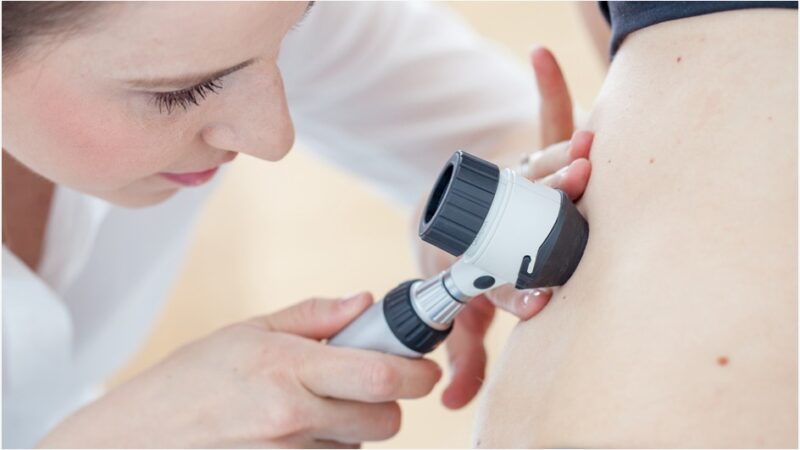 Inscripciones abiertas para la charla médica sobre cáncer de piel en el CEMENURNK